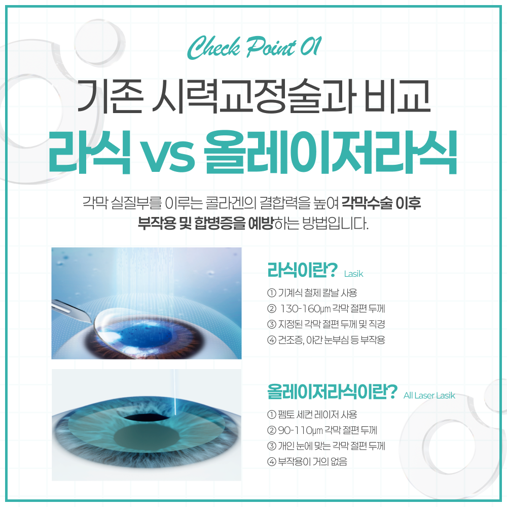 연신내라식 올레이저라식 수술 원리 이미지