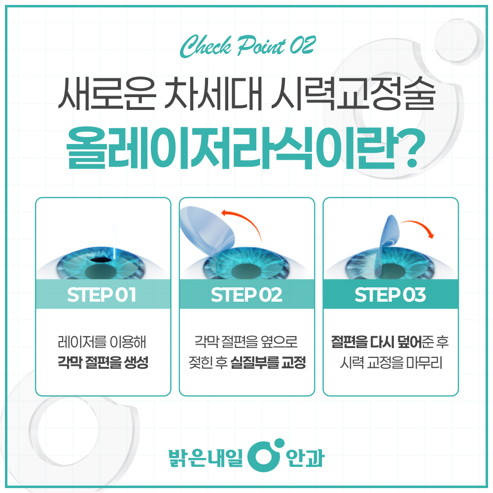 은평구안과 올레이저라식 정밀검사 이미지