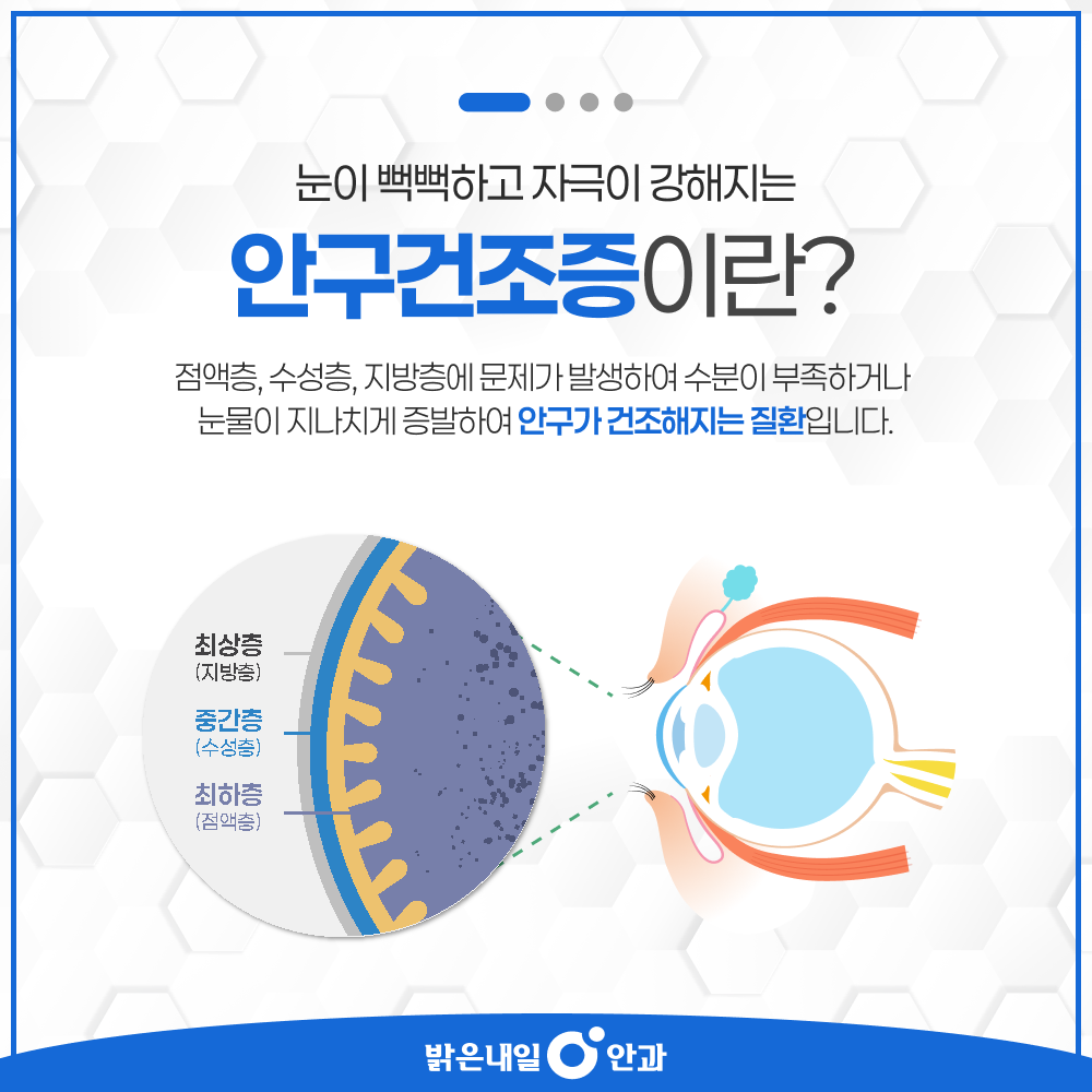 은평구 안구건조증 안내 이미지 2 - 눈물막 3층 구조